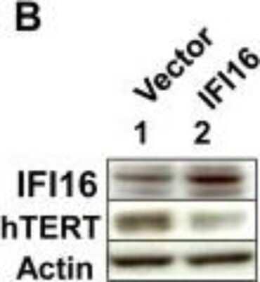 Western Blot: TERT Antibody (2C4)Azide and BSA Free [NBP2-80975]