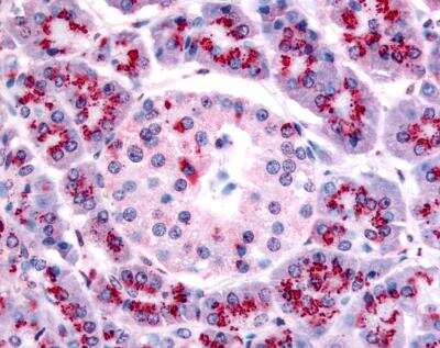 Immunohistochemistry-Paraffin: TERT Antibody (2C4) [NB100-317]