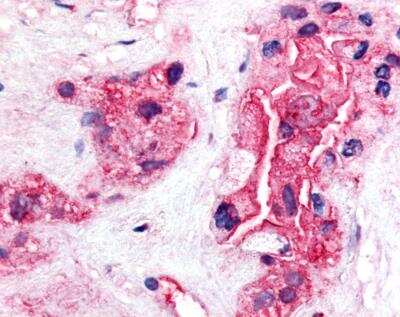 Immunohistochemistry-Paraffin: TERT Antibody (2C4) [NB100-317]