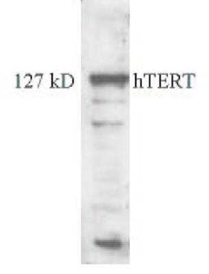 Western Blot: TERT Antibody (2C4) [NB100-317]
