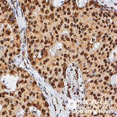 Immunohistochemistry-Paraffin: TERT Antibody (2D8) [NB100-297]