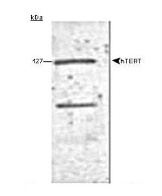 Western Blot: TERT Antibody (2D8) [NB100-297]