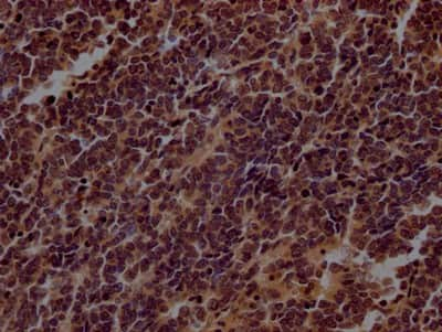 Immunohistochemistry: TERT Antibody (5C11) [NBP3-15241]