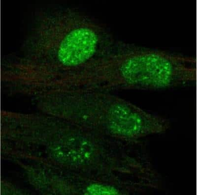 Immunocytochemistry/ Immunofluorescence: TERT Antibody [NBP2-56116]