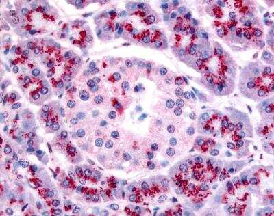 Immunohistochemistry-Paraffin: TERT Antibody Pack [NB100-913]