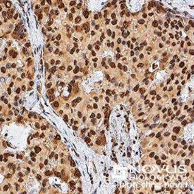 Immunohistochemistry-Paraffin: TERT Antibody Pack [NB100-913]