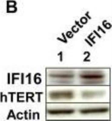 Western Blot: TERT Antibody Pack [NB100-913]
