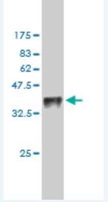 Western Blot: TESK1 Antibody (1D11) [H00007016-M01]