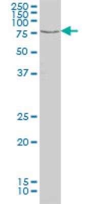 Western Blot: TESK2 Antibody (1A8) [H00010420-M01]