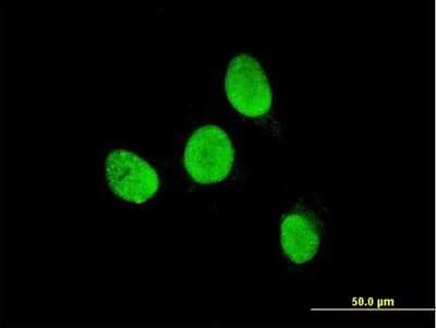 Immunocytochemistry/ Immunofluorescence: TESK2 Antibody (5G1) [H00010420-M08]