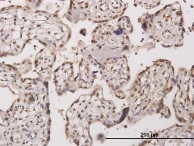 Immunohistochemistry-Paraffin: TESK2 Antibody (5G1) [H00010420-M08]