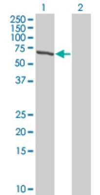 Western Blot: TESK2 Antibody (5G1) [H00010420-M08]