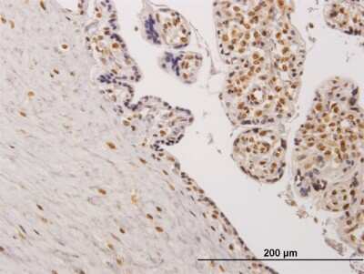 Immunohistochemistry-Paraffin: TESK2 Antibody (5H4) [H00010420-M04]