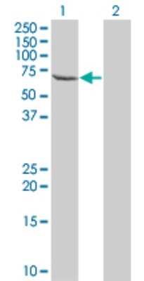 Western Blot: TESK2 Antibody (5H4) [H00010420-M04]