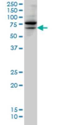 Western Blot: TESK2 Antibody (6C7) [H00010420-M02]