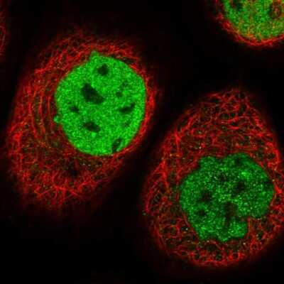 Immunocytochemistry/ Immunofluorescence: TESK2 Antibody [NBP1-89442]