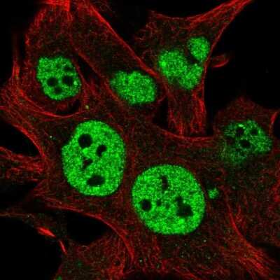 Immunocytochemistry/ Immunofluorescence: TESK2 Antibody [NBP2-57017]