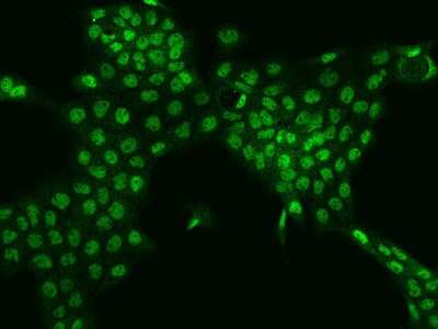 Immunocytochemistry/ Immunofluorescence: TESK2 Antibody [NBP2-98073]