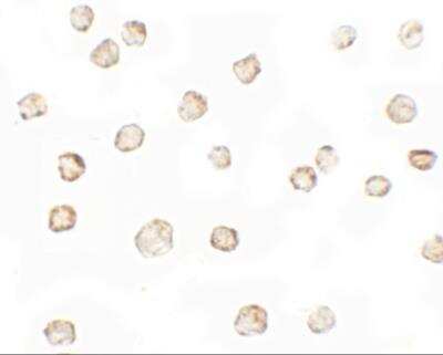 Immunocytochemistry/ Immunofluorescence: TESPA1 Antibody - BSA Free [NBP2-81842]