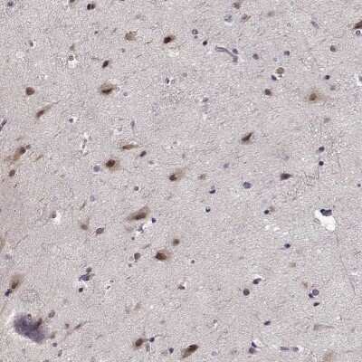 Immunohistochemistry-Paraffin: TESPA1 Antibody [NBP2-58111]