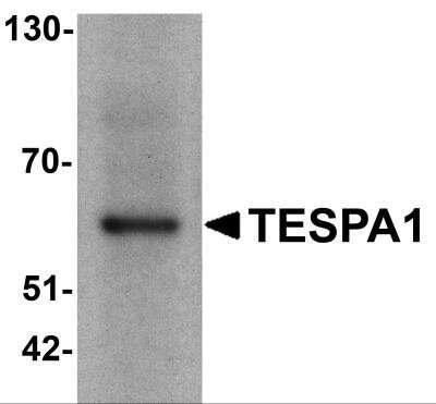 Western Blot: TESPA1 AntibodyBSA Free [NBP2-81842]