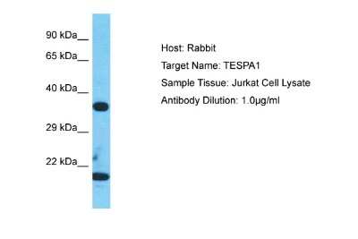 Western Blot: TESPA1 Antibody [NBP2-83642]