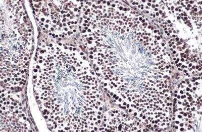 Immunohistochemistry-Paraffin: TET1 Antibody (1462) [NBP2-15135]