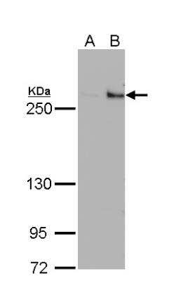 Western Blot: TET1 Antibody (1462) [NBP2-15135]