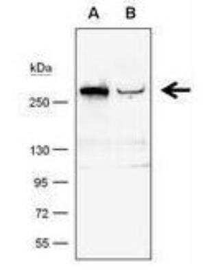 Western Blot: TET1 Antibody (1462) [NBP2-15135]