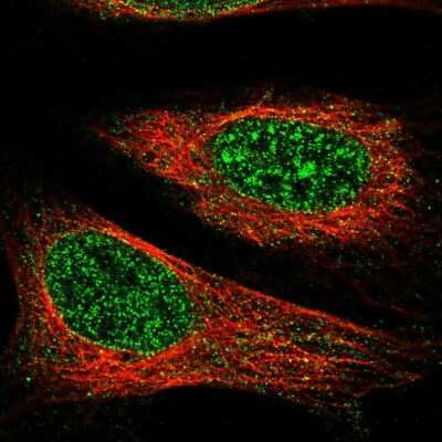 Immunocytochemistry/ Immunofluorescence: TET1 Antibody [NBP1-88972]