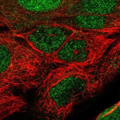 Immunocytochemistry/ Immunofluorescence: TET1 Antibody [NBP2-58496]