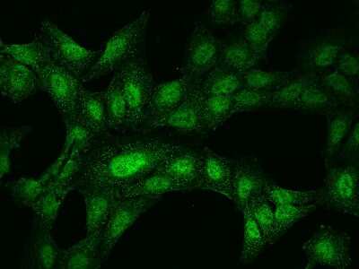 Immunocytochemistry/ Immunofluorescence: TET1 Antibody [NBP2-97605]