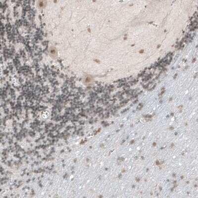 Immunohistochemistry-Paraffin: TET1 Antibody [NBP1-88972]