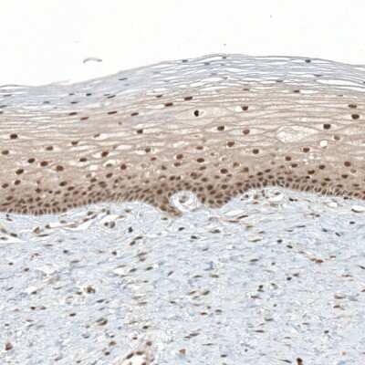 Immunohistochemistry-Paraffin: TET1 Antibody [NBP1-88972]
