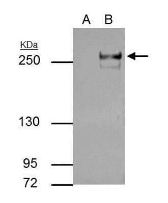 Immunoprecipitation: TET2 Antibody (411) [NBP2-43682]