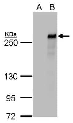 Western Blot: TET2 Antibody (411) [NBP2-43682]