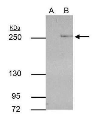Immunoprecipitation: TET2 Antibody (442) [NBP2-43579]