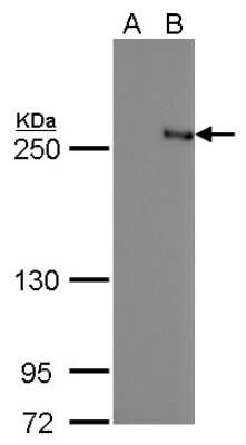 Western Blot: TET2 Antibody (442) [NBP2-43579]