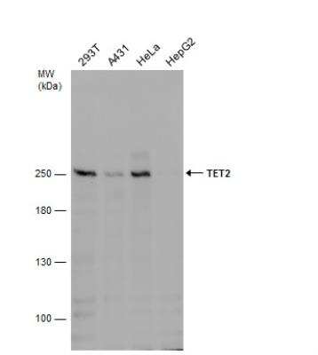 Western Blot: TET2 Antibody (649) [NBP2-43552]