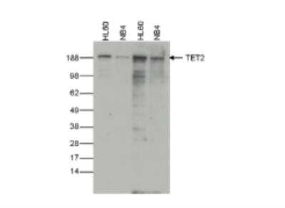 Western Blot: TET2 Antibody (C.15200179) [NBP2-59256]