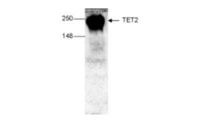 Western Blot: TET2 Antibody (C.15200179) [NBP2-59256]