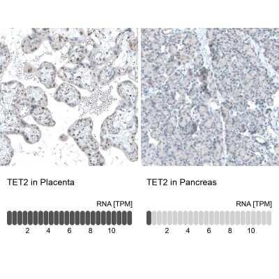 Immunohistochemistry-Paraffin: TET2 Antibody (CL6873) [NBP2-76510]