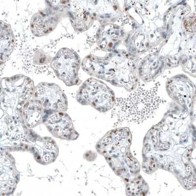 Immunohistochemistry-Paraffin: TET2 Antibody (CL6873) [NBP2-76510]