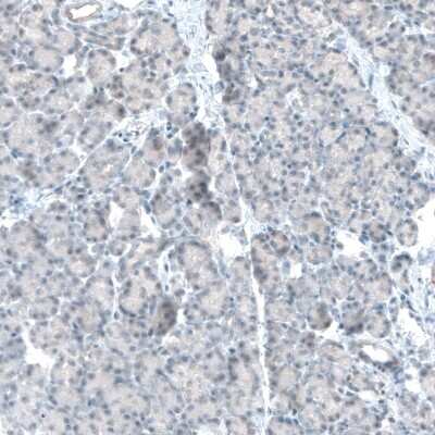 Immunohistochemistry-Paraffin: TET2 Antibody (CL6873) [NBP2-76510]