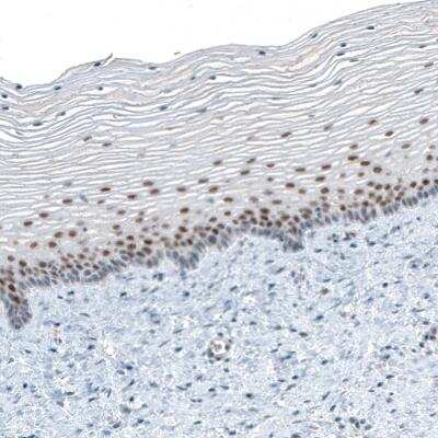 Immunohistochemistry-Paraffin: TET2 Antibody (CL6873) [NBP2-76510]