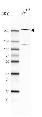 Western Blot: TET2 Antibody (CL6873) [NBP2-76510]