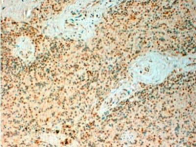 Immunohistochemistry-Paraffin: TET2 Antibody [NBP2-27465]