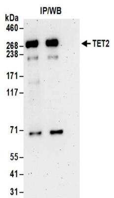 Western Blot: TET2 Antibody [NBP2-32104]