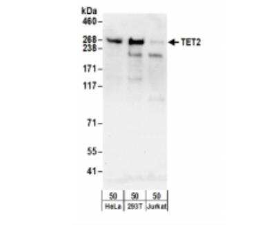 Western Blot: TET2 Antibody [NBP2-32104]