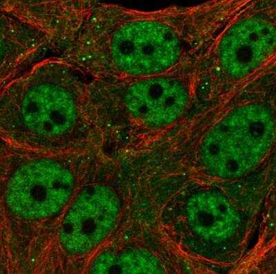 Immunocytochemistry/ Immunofluorescence: TET3 Antibody [NBP2-13427]